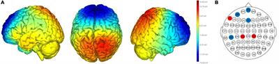 Network-Based Transcranial Direct Current Stimulation May Modulate Gait Variability in Young Healthy Adults